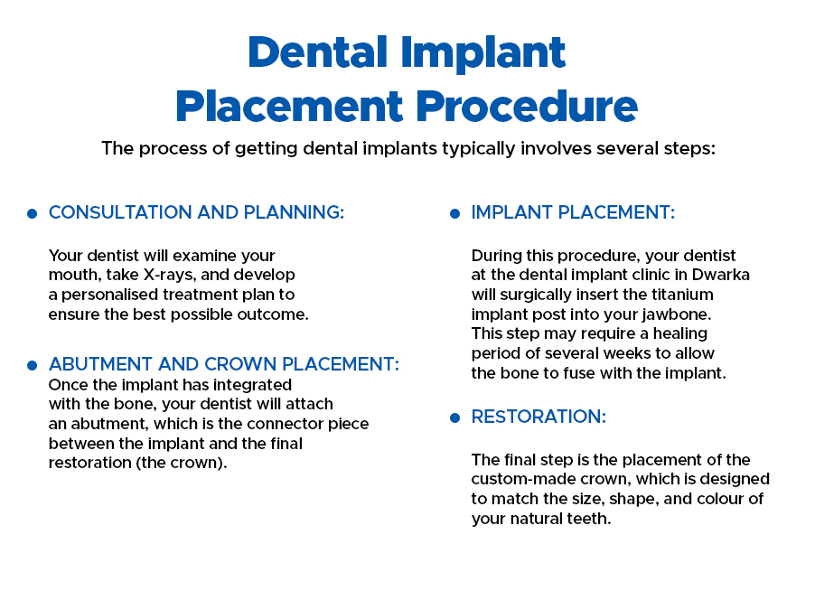 Dental Implant Placement Procedure